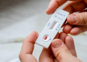 Coronavirus: para evitar las largas filas de testeo, en enero podrían autorizar los autotest para el hogar