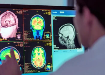 Covid: ¿Cuáles son los daños cerebrales que pueden padecer los pacientes recuperados?