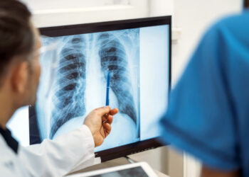Especialistas remarcan la necesidad de detectar a tiempo el cáncer de pulmón