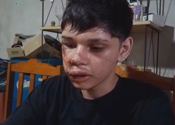 Un menor denunció que fue golpeado por policías de Concordia