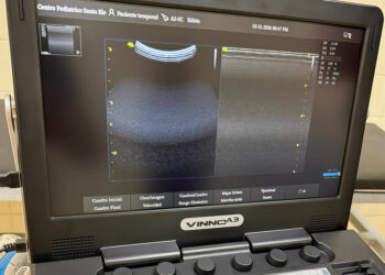 Salud incorporó ecógrafos en tres hospitales para fortalecer la atención sanitaria